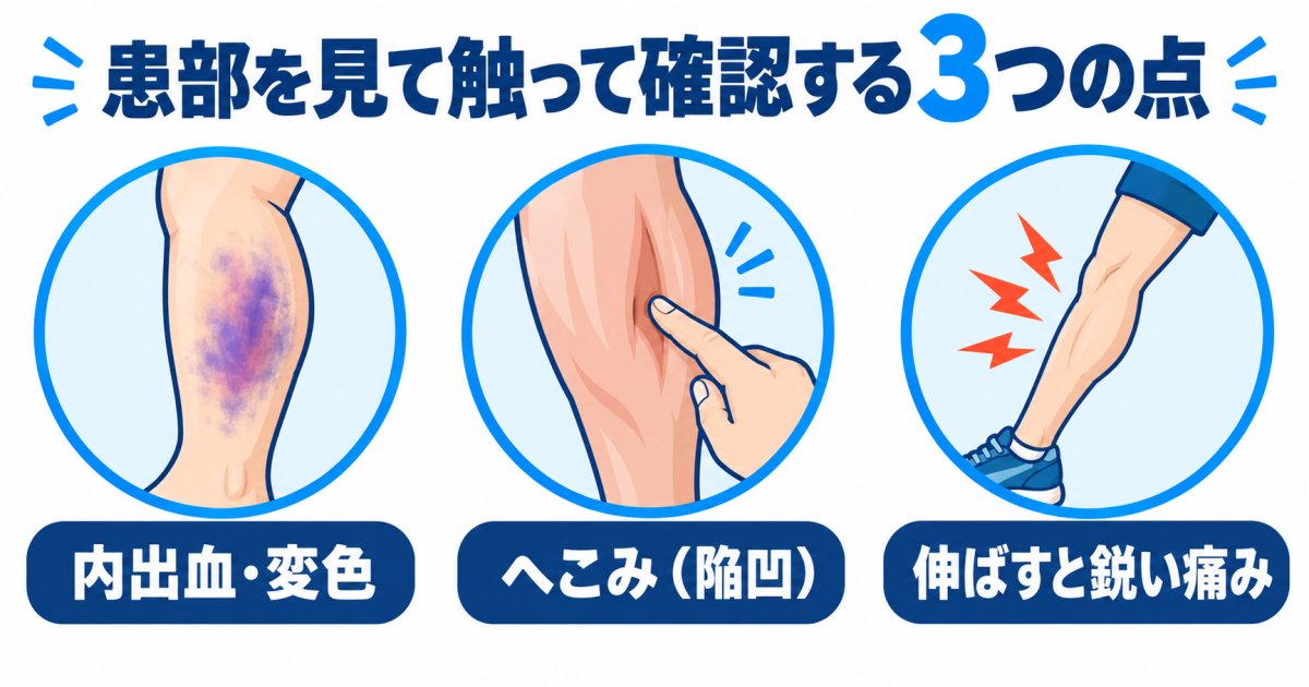 患部の腫れ・内出血・へこみで見分ける